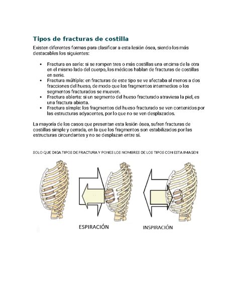 Métodos de diagnóstico para fracturas de costilla