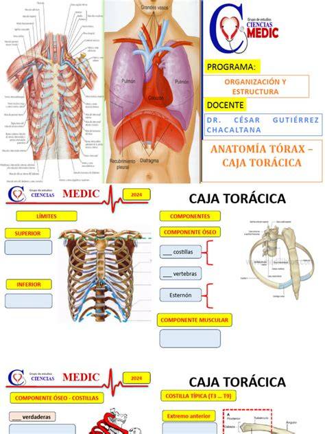 Esquema de la anatomía torácica y ubicación de la incisión de toracotomía