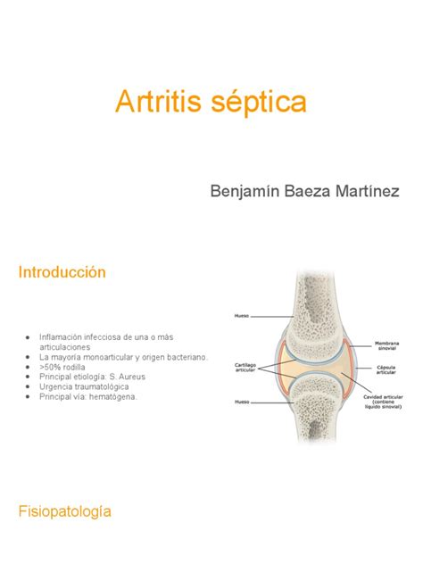 Articulaciones comúnmente afectadas por la artritis séptica en corderos