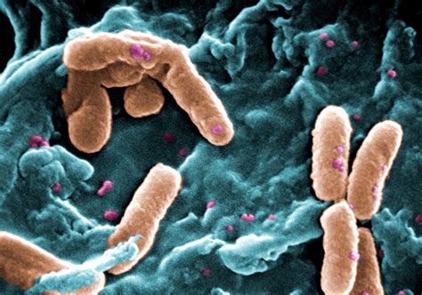 Micrografía de la bacteria Pseudomonas aeruginosa