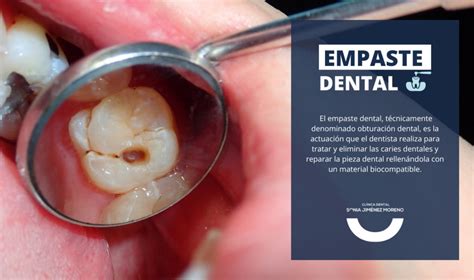 Esquema comparativo de empaste y corona dental