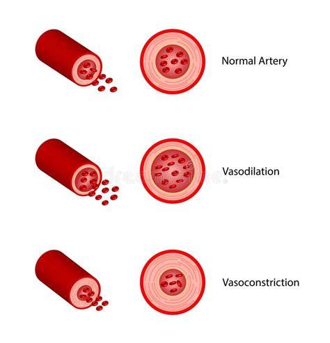 Diagrama de los mecanismos de vasoconstricción y necrosis por cocaína