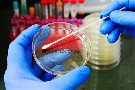 Proceso de toma de muestra para cultivo bacteriano.