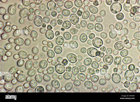 Saccharomyces cerevisiae bajo el microscopio