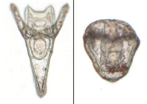 Larva equinoplúteus de erizo de mar