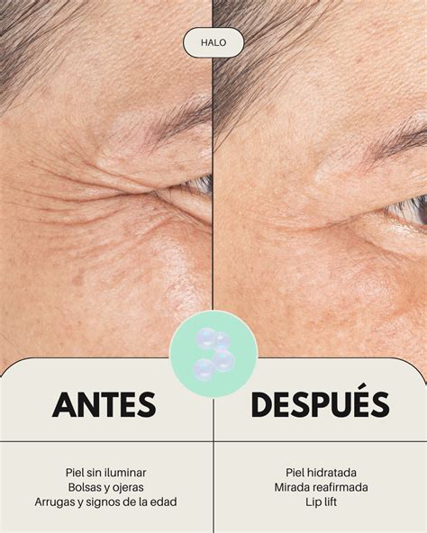 Comparativa antes y después de usar un contorno de ojos