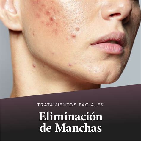 Proceso de eliminación de manchas de grasa