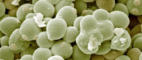 Levadura Saccharomyces cerevisiae bajo estrés oxidativo