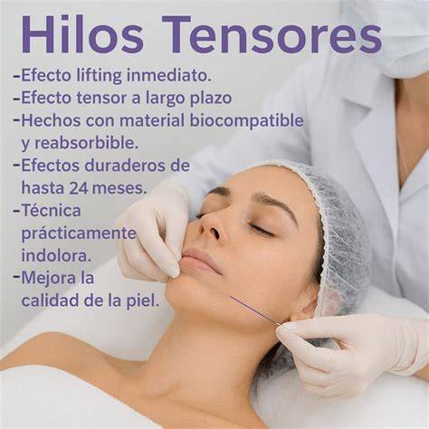Gráfico de precios aproximados de hilos tensores según la zona