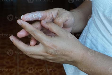Primer plano de una persona aplicando el spray en sus pies cansados