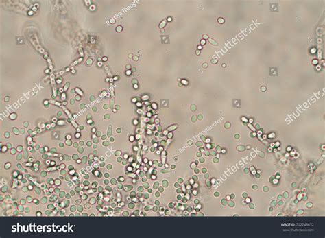 Microorganismos de levadura bajo microscopio