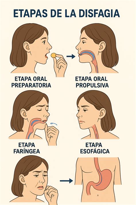Diferencias entre fagofobia y disfagia