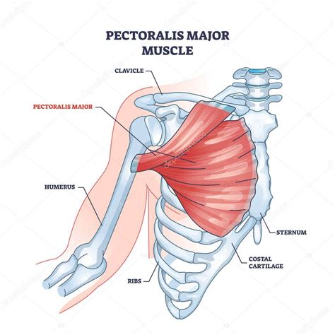 Diagrama mostrando el músculo pectoral de un pollo y la zona afectada por DPM