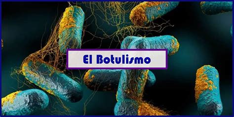 Diagrama de cómo Clostridium botulinum causa el botulismo