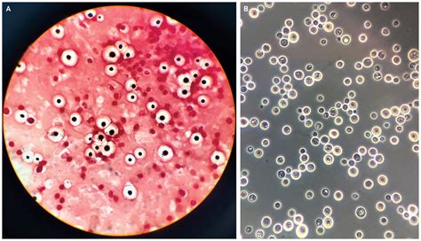 Micrografía de Cryptococcus neoformans con su cápsula