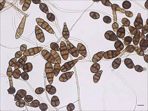Micrografía de esporas de Alternaria alternata
