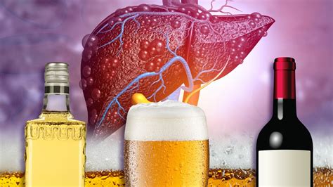 bebidas alcohólicas dañando el hígado