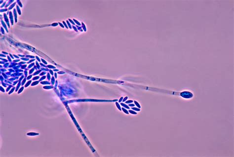 Ilustración del hongo Fusarium proliferatum al microscopio