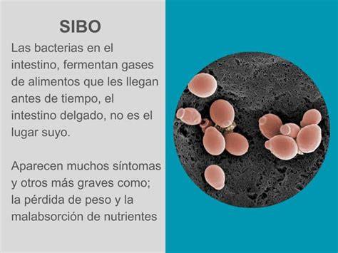 Infografía sobre las consecuencias del SIBO en la absorción de nutrientes