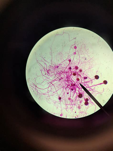 Representación microscópica de Rhizopus stolonifer