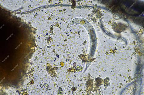 Microorganismos en un microscopio